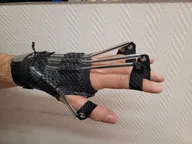 Orthèse orthopédique réalisée sur mesure